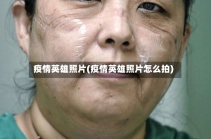 疫情英雄照片(疫情英雄照片怎么拍)