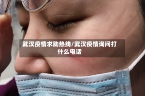 武汉疫情求助热线/武汉疫情询问打什么电话