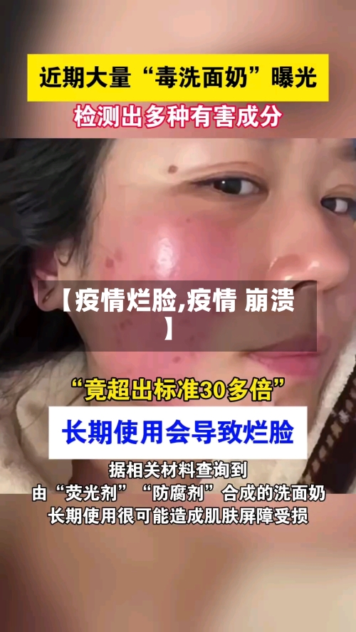 【疫情烂脸,疫情 崩溃】-第1张图片