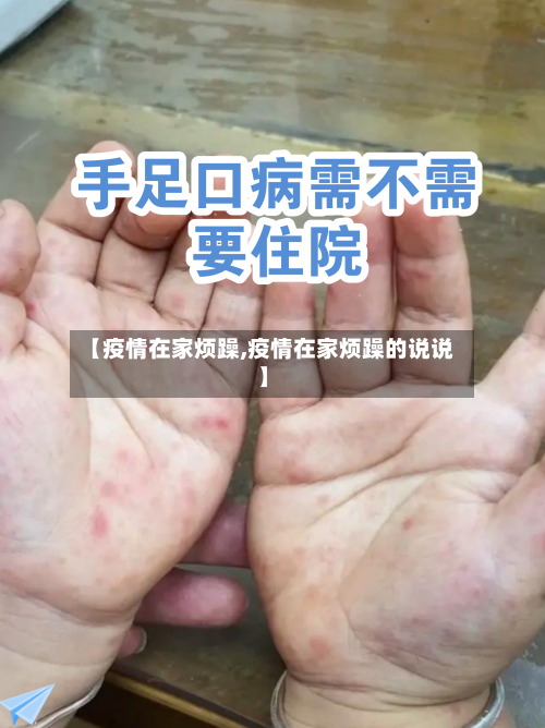 【疫情在家烦躁,疫情在家烦躁的说说】-第2张图片