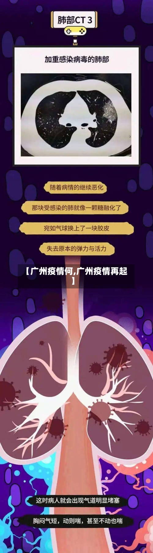 【广州疫情何,广州疫情再起】-第1张图片