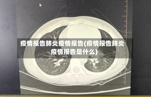疫情报告肺炎疫情报告(疫情报告肺炎疫情报告是什么)-第1张图片