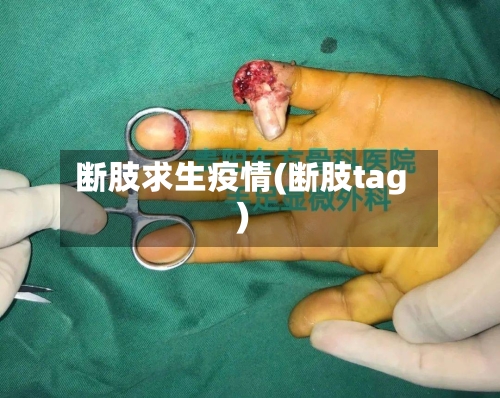 断肢求生疫情(断肢tag)-第1张图片