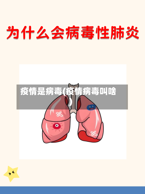 疫情是病毒(疫情病毒叫啥)-第2张图片