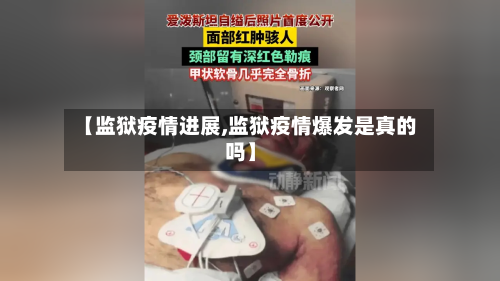 【监狱疫情进展,监狱疫情爆发是真的吗】-第1张图片